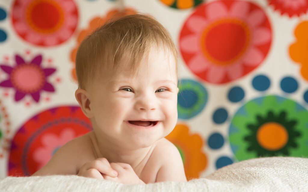 Down Syndrome births plummet due to high abortion rates, but advocates highlight each "wonderful, beautiful life